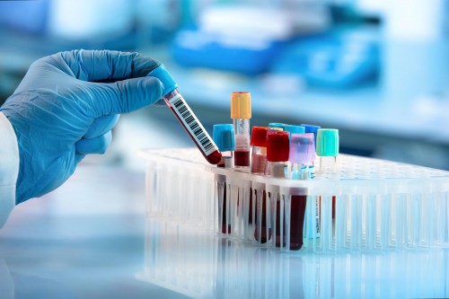 Laboratoires de biologie médicale : les actes délocalisés désormais encadrés